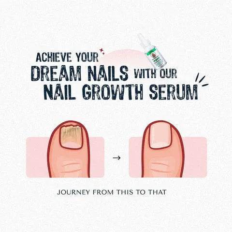 Nail Serum for Long healthy & fungus free nails - Liveonease