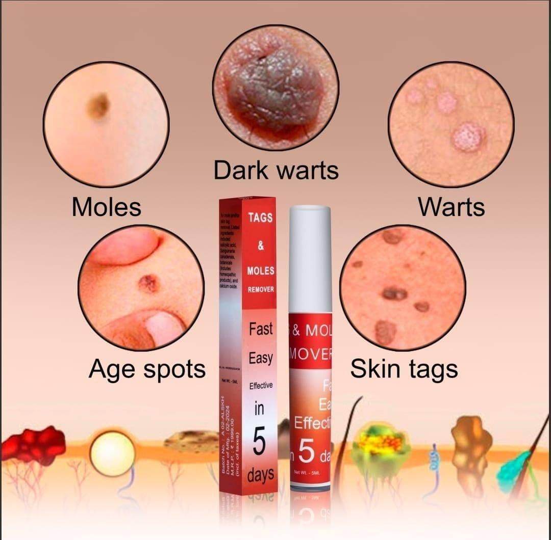Tags & Moles Remover BUY 1 GET 1 FREE - Liveonease