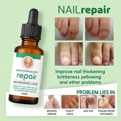 Nail Serum for Long healthy & fungus free nails