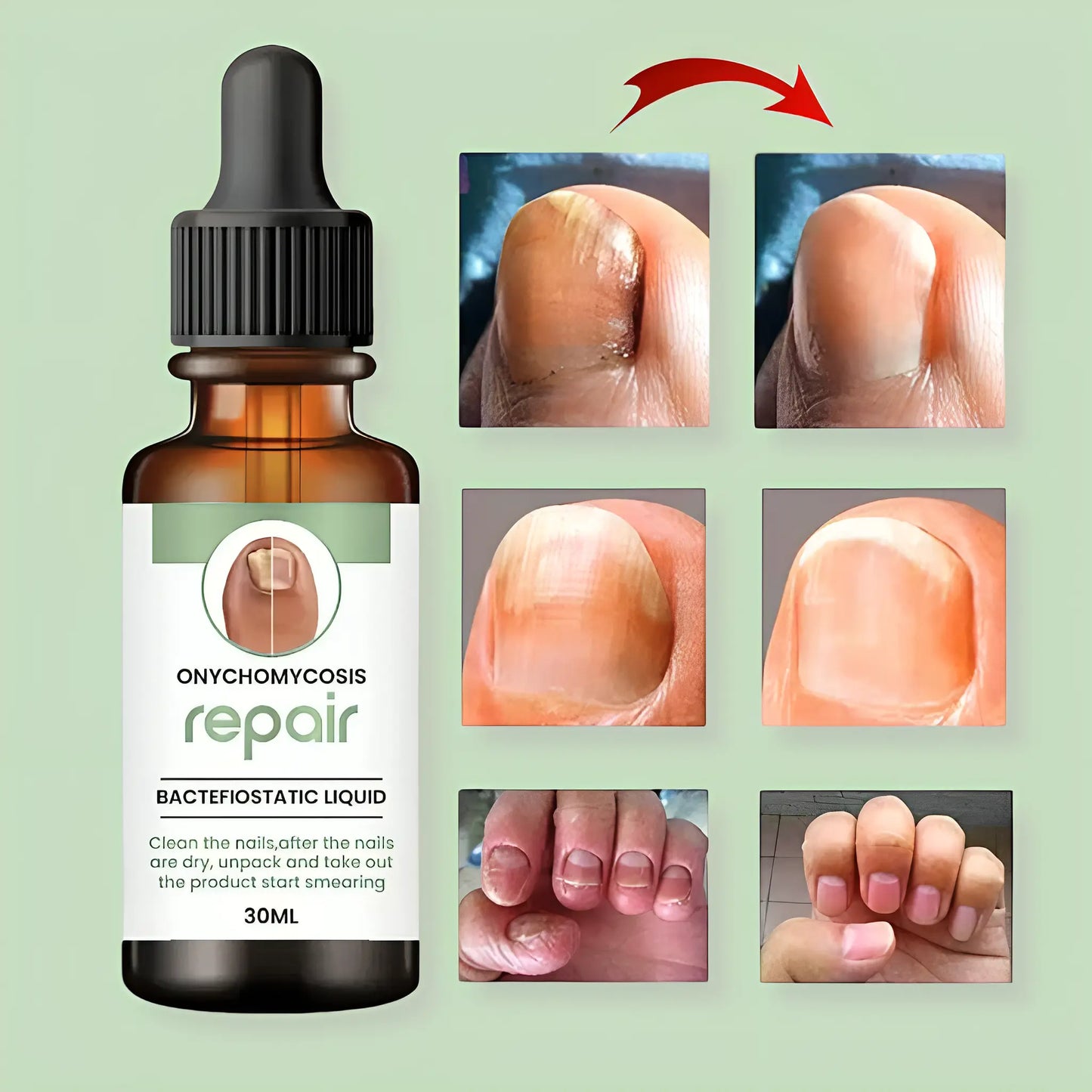 Nail Serum for Long healthy & fungus free nails