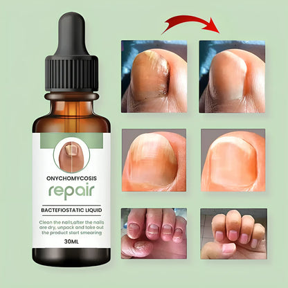 Nail Serum for Long healthy & fungus free nails